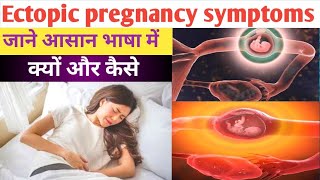 Ectopic Pregnancy  Symptoms of ectopic pregnancy  Ectopic pregnancy pain  DrNehaMehta medic [upl. by Narok]