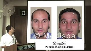 How to choose a Hair Transplant Surgeon FUT or FUE Cost Medispa By Dr Suneet Soni Jaipur Delhi [upl. by Horvitz]