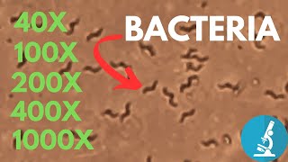 Bacteria under Microscope at Different Magnification  Do you really need 1000x [upl. by Asenaj]