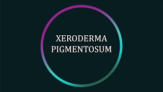 What is Xeroderma Pigmentosum XP [upl. by Carmel]