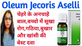 Oleum Jecoris Aselli  Oleum Jecoris 3x Benefits  अनचाहे बाल हटानेकमजोरी दूर करने की बेस्ट दवा [upl. by Muriel]