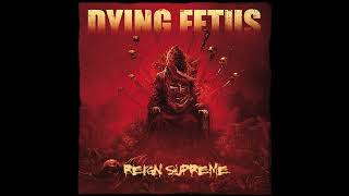 Dying Fetus  Subjected to a Beating Instrumental [upl. by Geminius]