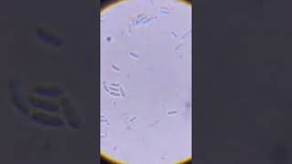 Lactobacillus ultra structure of lactobacillus shortvideo shortsvideo shorts lactobacillus [upl. by Edvard531]