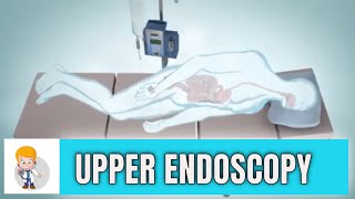 Upper GI endoscopy Esophagogastroduodenoscopy Animation 3D [upl. by Amalbergas92]