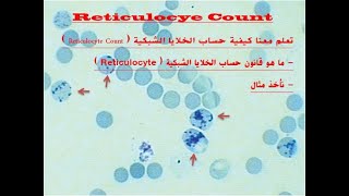 Reticulocyte Count [upl. by Anerul]