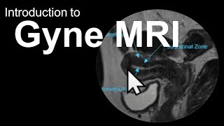 Introduction to Gyne MRI Female Pelvis CaseBased Course [upl. by Asante]