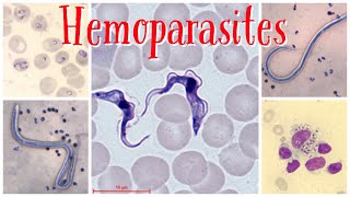 Hemoparasites pathology pathologylab hematology smear parasite [upl. by Airdni]