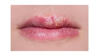 Mayo Clinic Minute 3 things you didnt know about cold sores [upl. by Yelhs]