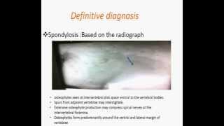 Spondylosis deformans [upl. by Eidod]