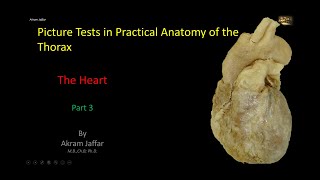 Picture Tests in Anatomy  Thorax  Heart 3 [upl. by Kcirb219]