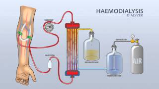 HAEMODIALYSIS DIALYZER [upl. by Nolly]