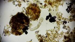 Rotifer  Rädertierchen  microorganisms under a microscope  microorganism in 1080p Full HD [upl. by Ayres961]