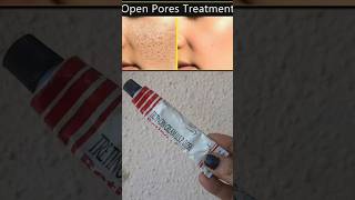 Open pores removal best cream retino a cream remove open pores skincare shortsvideo [upl. by Harolda]