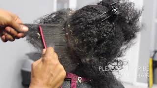 Picking BIG scalp flakes Psoriasis and Dermatitis SEW IN WEAVE REMOVAL [upl. by Ahsenyl]