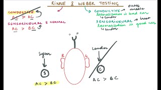 Rinne amp Weber Testing [upl. by Carrie67]