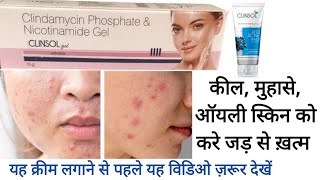 Clinsol Gel Cream  पिम्पल को करे जड़ से ख़त्म [upl. by Aicissej]