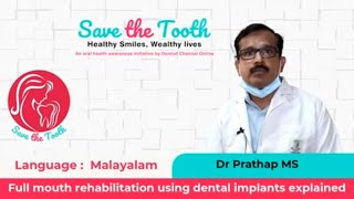 Full mouth rehabilitation using dental implants explained  Malayalam  103 [upl. by Iroc]