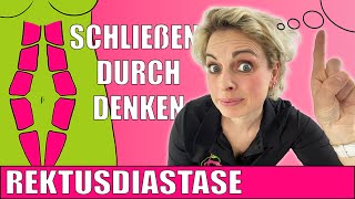 9💡WOW💡Durch Denken die Rektusdiastase schließen❓Das geht❗️Diese Übungen  Übung beim Schliessen❗️ [upl. by Drehcir253]