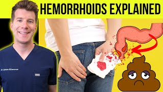 Doctor explains HEMORRHOIDS aka piles  Causes symptoms treatment amp prevention [upl. by Eirovi]