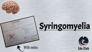 Syringomyelia  CNS Physiology [upl. by Friday]