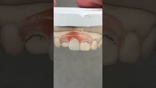 Nesbit Incisor dental teeth smile lsk121shorts shorts shortvideoEnvisiontecMainenvisiontec [upl. by Annahc803]