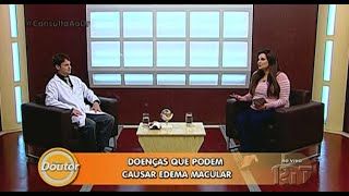 Doenças que podem causar edema macular RIT TV Consulta ao Doutor 28 02 2020 Entrevista com o Dr [upl. by Sink]