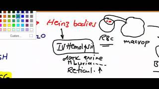 Usmle Step 1 Hematology 23 video [upl. by Small]