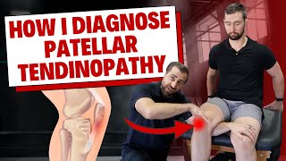 How I Diagnose Patellar Tendinopathy Clinical Examination [upl. by Serg716]