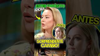 el CAMBIO FÍSICO de ESTER EXPOSITO Shorts EsterExposito Elite AntesYDespues Noticias [upl. by Sugden]