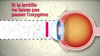 Lentilles de contact  attention les yeux [upl. by Hacim971]