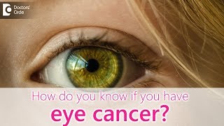 How do you know if you have eye cancer  Dr Sunita Rana Agarwal [upl. by Porte]