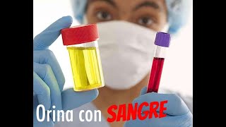 ¿Tu Orina Tiene COLOR ROJO 🩸 salud orina enfermera [upl. by Stannwood]