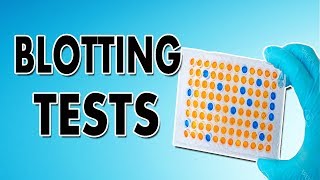 Blotting Techniques Western Blot Southern Blot and Northern Blot [upl. by Ghiselin599]