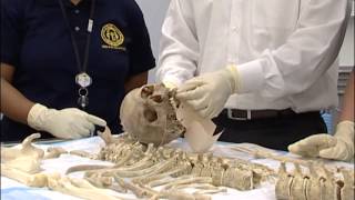 Medical Examiner System Evidence Guidelines [upl. by Thorncombe447]