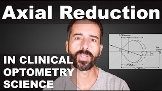 Adult Reduction In Eyeball Axial Length  Emmetropization Mechanism  EM  Reduced Lens Method ™ [upl. by Alad]