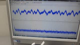 樹脂容器の特性を利用した表面改質技術ーー音圧測定用部材に関する表面残留応力の緩和・均一化処理ーー（超音波システム研究所） [upl. by Ninel330]