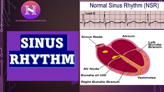 NORMAL SINUS RHYTHM EKG ECG INTERPRETATION [upl. by Netsew341]