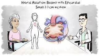 AtriCure Patient Atrial Fibrillation Animation [upl. by Sadler113]