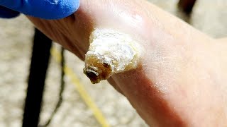 😮How To Put On Shoes Amazing Pedicure Results【Xue Yidao】 [upl. by Ycinuq748]