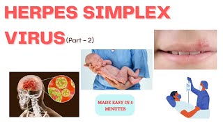 Herpes simplex virus  Treatment  In just 5 minutes  Medinare [upl. by Christabella75]