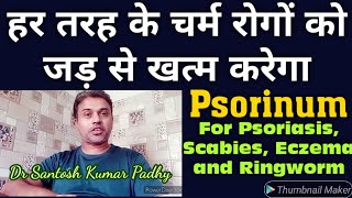 Psorinum  Top Homeopathic medicine for all skin problems like Scabies Psoriasis Eczema Ringworm [upl. by Perry]