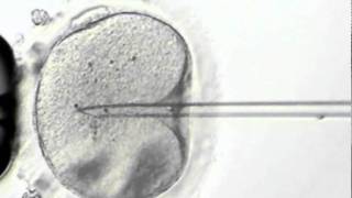 Intracytoplasmic sperm Injection ICSI [upl. by Eilitan]