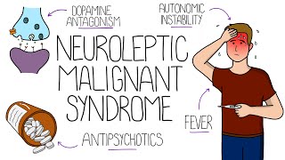 Neuroleptic Malignant Syndrome NMS Explained [upl. by Ocimad562]