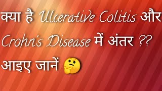 Ulcerative Colitis Versus Crohns Disease in Hindi Language [upl. by Kilah]