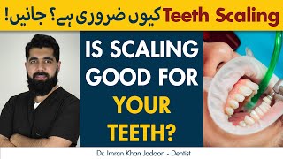 Is Scaling Good For Your Teeth  Why Do We Need Teeth Scaling [upl. by Geralda]