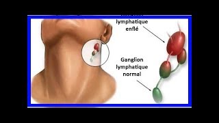 L’inflammation des ganglions lymphatiques  quelle en est la cause [upl. by Ylagam]