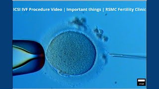 ICSI IVF Procedure Video  Important things  RSMC Fertility Clinic [upl. by Kylie]