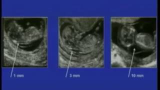 AIUM Guidelines for Obstetrical Ultrasound [upl. by Veats]