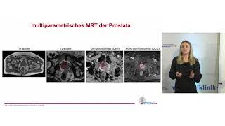 Diagnostik und Therapie beim Prostatakarzinom  Prof Dr Cordula Jilg [upl. by Malcom754]