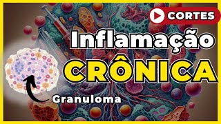 Inflamação Crônica  Patologia Geral [upl. by Warring]